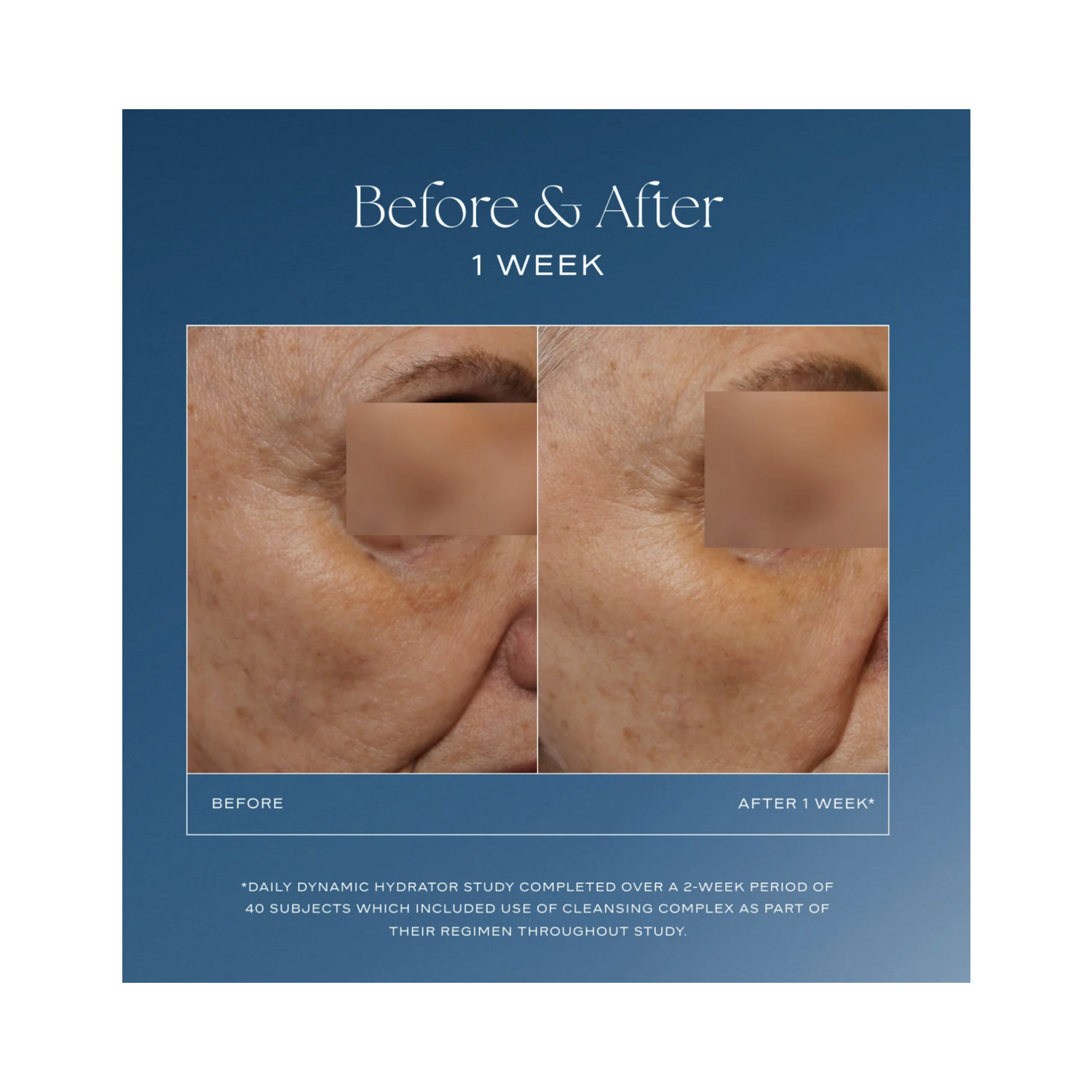 iS Clinical Daily Dynamic Hydrator