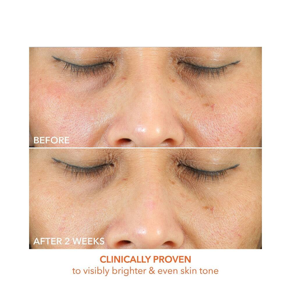 丹尼斯博士毛毛维生素C +乳酸无油辐射保湿剂